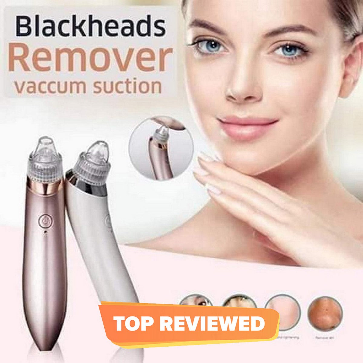 Rechargeable Blackhead Removal Machine